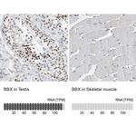 BBX Antibody in Immunohistochemistry (IHC)