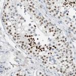 BBX Antibody in Immunohistochemistry (IHC)