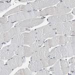 BBX Antibody in Immunohistochemistry (IHC)