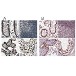 ELF2 Antibody in Immunohistochemistry (IHC)