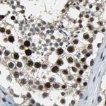 ELF2 Antibody in Immunohistochemistry (IHC)