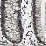 ELF2 Antibody in Immunohistochemistry (IHC)