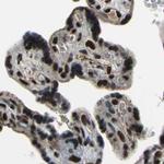 ELF2 Antibody in Immunohistochemistry (IHC)