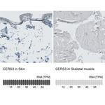 Lass3 Antibody in Immunohistochemistry (IHC)