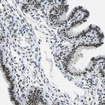 MORF Antibody in Immunohistochemistry (IHC)