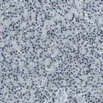MORF Antibody in Immunohistochemistry (IHC)
