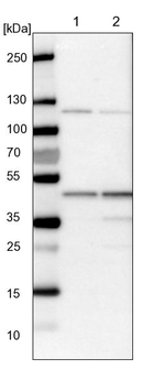 HMBS Antibody in Western Blot (WB)