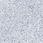 RPS12 Antibody in Immunohistochemistry (Paraffin) (IHC (P))