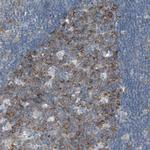 RPS12 Polyclonal Antibody