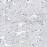 RPS12 Antibody in Immunohistochemistry (Paraffin) (IHC (P))