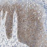 RPS12 Antibody in Immunohistochemistry (Paraffin) (IHC (P))