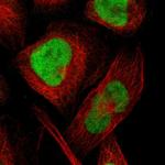 CXorf67 Polyclonal Antibody