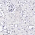 CXorf67 Antibody in Immunohistochemistry (IHC)