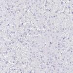 CXorf67 Antibody in Immunohistochemistry (IHC)