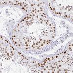 CXorf67 Antibody in Immunohistochemistry (IHC)