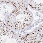 CXorf67 Antibody in Immunohistochemistry (IHC)
