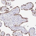 CXorf67 Antibody in Immunohistochemistry (IHC)