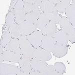 CXorf67 Antibody in Immunohistochemistry (IHC)