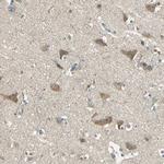 SCK Antibody in Immunohistochemistry (Paraffin) (IHC (P))