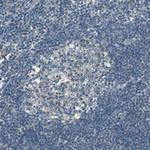 SCK Polyclonal Antibody