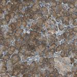 SCK Antibody in Immunohistochemistry (Paraffin) (IHC (P))