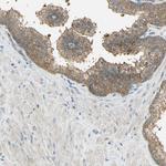 SCK Antibody in Immunohistochemistry (Paraffin) (IHC (P))