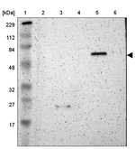 SCK Antibody in Western Blot (WB)