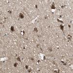 ZNF18 Antibody in Immunohistochemistry (Paraffin) (IHC (P))