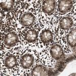 ZNF18 Antibody in Immunohistochemistry (Paraffin) (IHC (P))