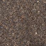 ZNF18 Antibody in Immunohistochemistry (Paraffin) (IHC (P))