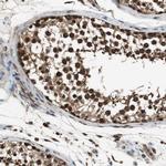 ZNF18 Antibody in Immunohistochemistry (Paraffin) (IHC (P))
