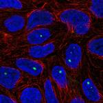 ZNF226 Polyclonal Antibody