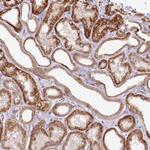 ZNF226 Antibody in Immunohistochemistry (Paraffin) (IHC (P))