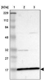 ZNF226 Antibody in Western Blot (WB)