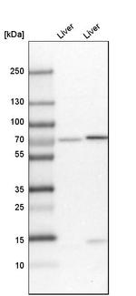 PDZK1 Antibody in Western Blot (WB)