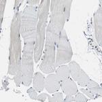 SOX30 Antibody in Immunohistochemistry (Paraffin) (IHC (P))
