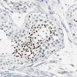 SOX30 Antibody in Immunohistochemistry (Paraffin) (IHC (P))