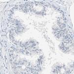 SOX30 Antibody in Immunohistochemistry (IHC)