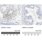 SOX30 Antibody