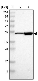 SOX30 Antibody in Western Blot (WB)