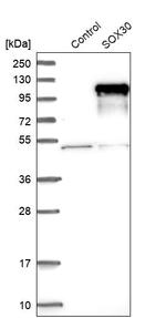SOX30 Antibody in Western Blot (WB)