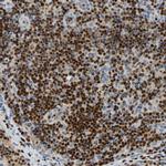 SP140 Antibody in Immunohistochemistry (IHC)