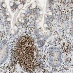 SP140 Antibody in Immunohistochemistry (IHC)