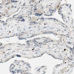 SP140 Antibody in Immunohistochemistry (IHC)