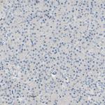 SP140 Antibody in Immunohistochemistry (IHC)