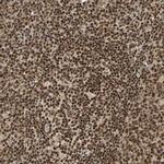 TAF5 Polyclonal Antibody