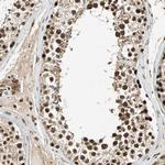 TAF5 Antibody in Immunohistochemistry (Paraffin) (IHC (P))