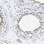 HCFC2 Antibody in Immunohistochemistry (IHC)