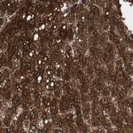 PI4KB Antibody in Immunohistochemistry (Paraffin) (IHC (P))