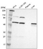 PI4KB Antibody in Western Blot (WB)